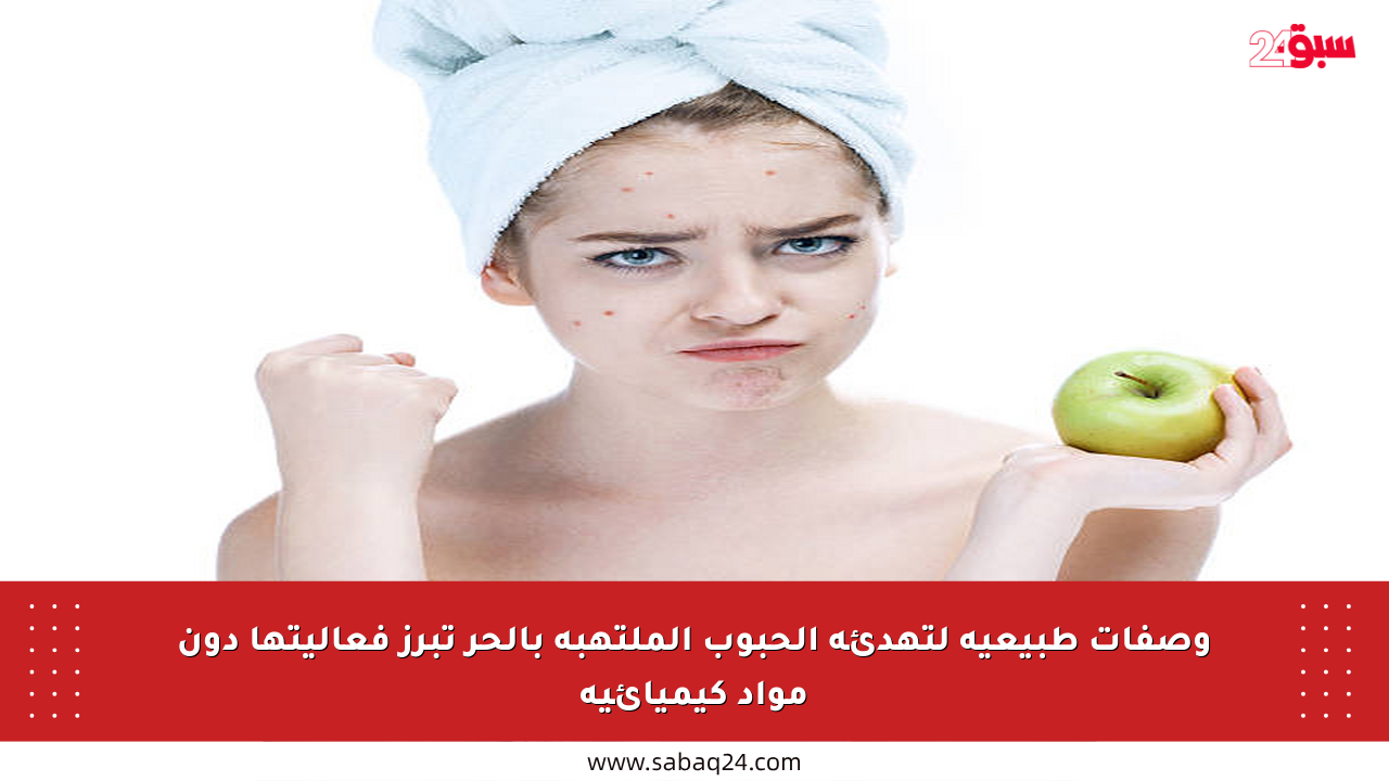 وصفات طبيعية لتهدئة الحبوب الملتهبة بالحر تبرز فعاليتها دون مواد كيميائية